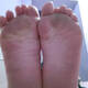 piedi puzzolenti